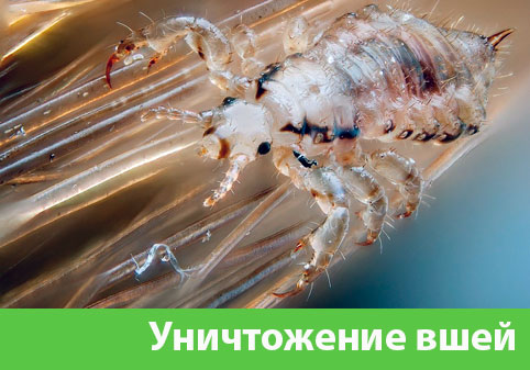 Уничтожение вшей в городе Москва